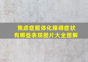 焦虑症躯体化障碍症状有哪些表现图片大全图解