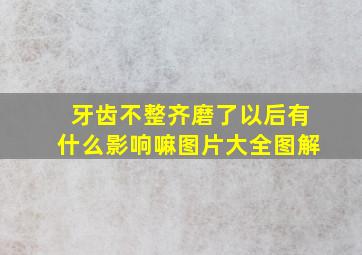 牙齿不整齐磨了以后有什么影响嘛图片大全图解