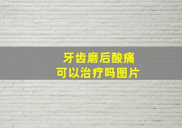 牙齿磨后酸痛可以治疗吗图片