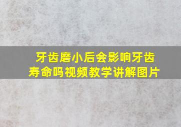 牙齿磨小后会影响牙齿寿命吗视频教学讲解图片