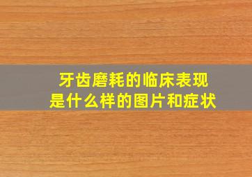 牙齿磨耗的临床表现是什么样的图片和症状