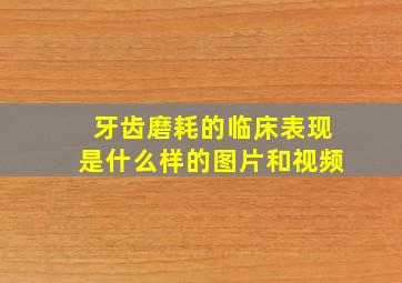 牙齿磨耗的临床表现是什么样的图片和视频