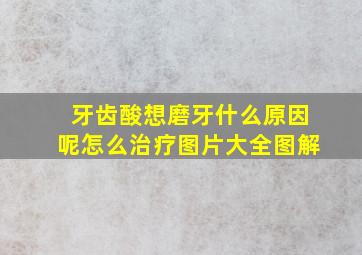 牙齿酸想磨牙什么原因呢怎么治疗图片大全图解