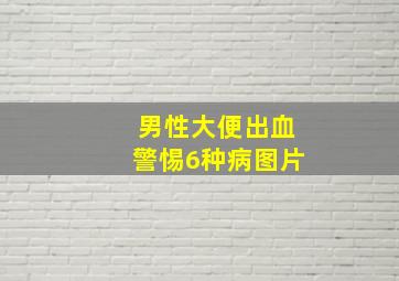 男性大便出血警惕6种病图片