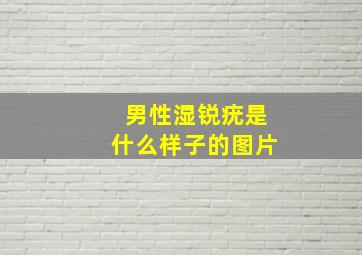 男性湿锐疣是什么样子的图片