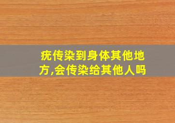 疣传染到身体其他地方,会传染给其他人吗