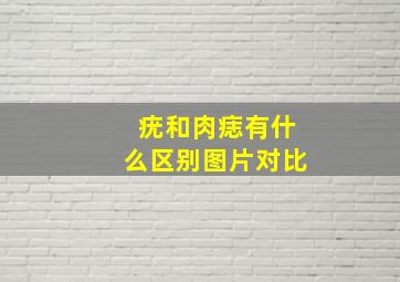 疣和肉痣有什么区别图片对比