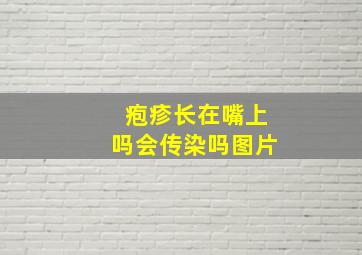 疱疹长在嘴上吗会传染吗图片