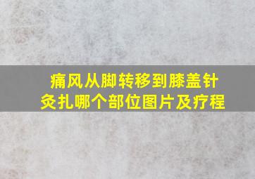 痛风从脚转移到膝盖针灸扎哪个部位图片及疗程