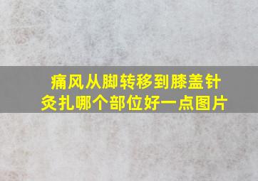 痛风从脚转移到膝盖针灸扎哪个部位好一点图片