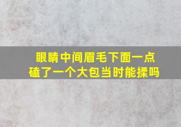 眼睛中间眉毛下面一点磕了一个大包当时能揉吗