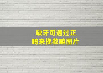 缺牙可通过正畸来挽救嘛图片