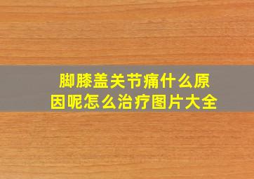 脚膝盖关节痛什么原因呢怎么治疗图片大全