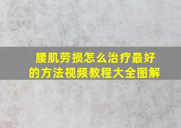 腰肌劳损怎么治疗最好的方法视频教程大全图解