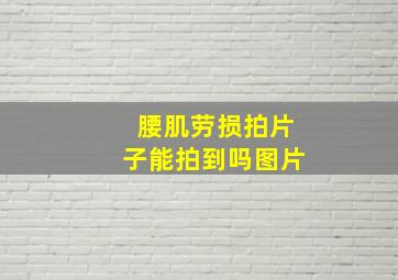 腰肌劳损拍片子能拍到吗图片