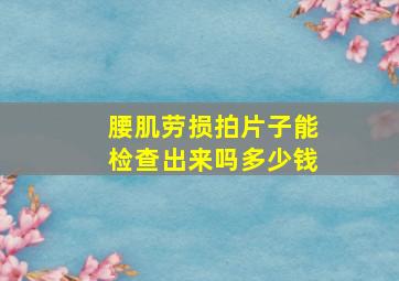 腰肌劳损拍片子能检查出来吗多少钱