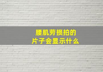 腰肌劳损拍的片子会显示什么