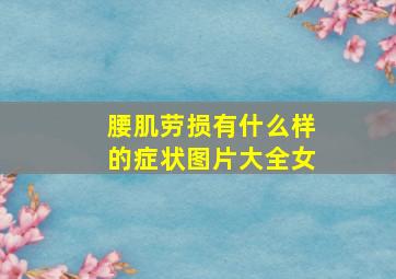 腰肌劳损有什么样的症状图片大全女