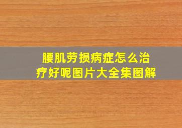 腰肌劳损病症怎么治疗好呢图片大全集图解