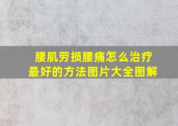 腰肌劳损腰痛怎么治疗最好的方法图片大全图解