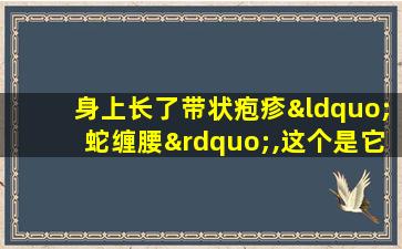 身上长了带状疱疹“蛇缠腰”,这个是它的克星!